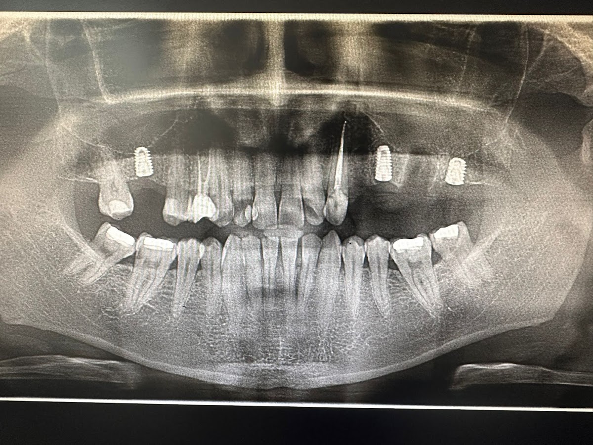 Dental Klinik Sağlık hizmetleri Manavgat