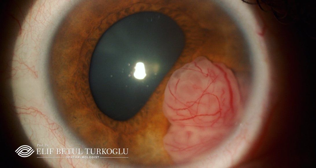 Diş Hekimi ve Klinikleri Betül Doğmuş Tarakçıoğlu — Manavgat Antalya