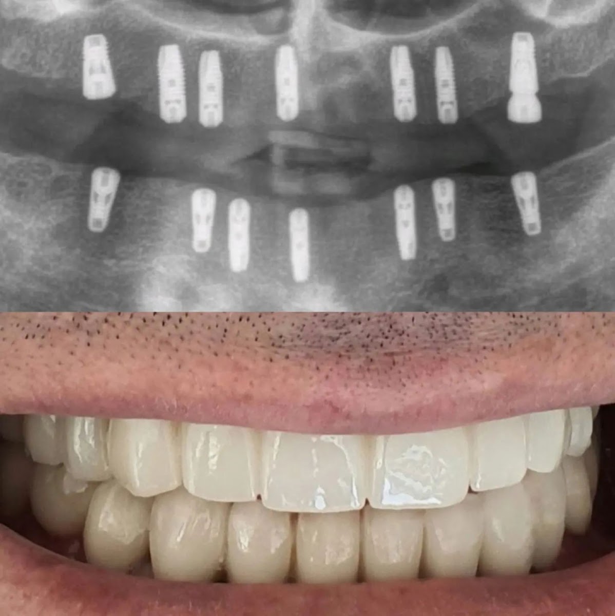 Kadir Deveci Manavgat