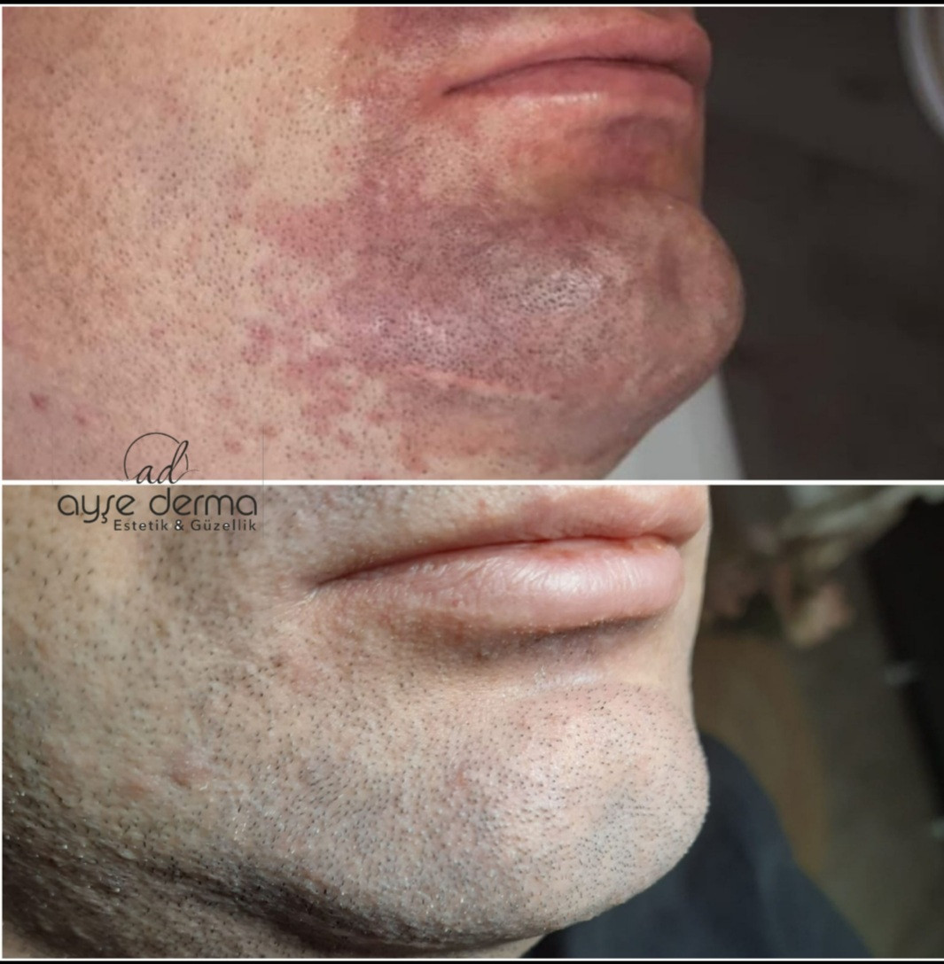 Ayşe Derma – Fotoğraf 6