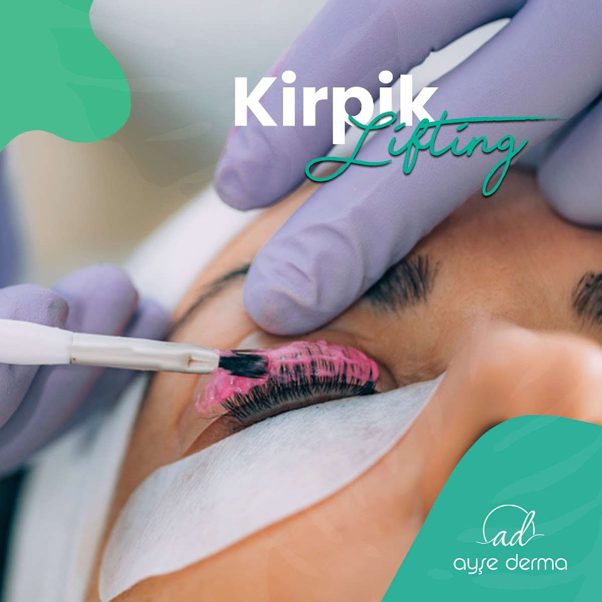 Ayşe Derma – Fotoğraf 5