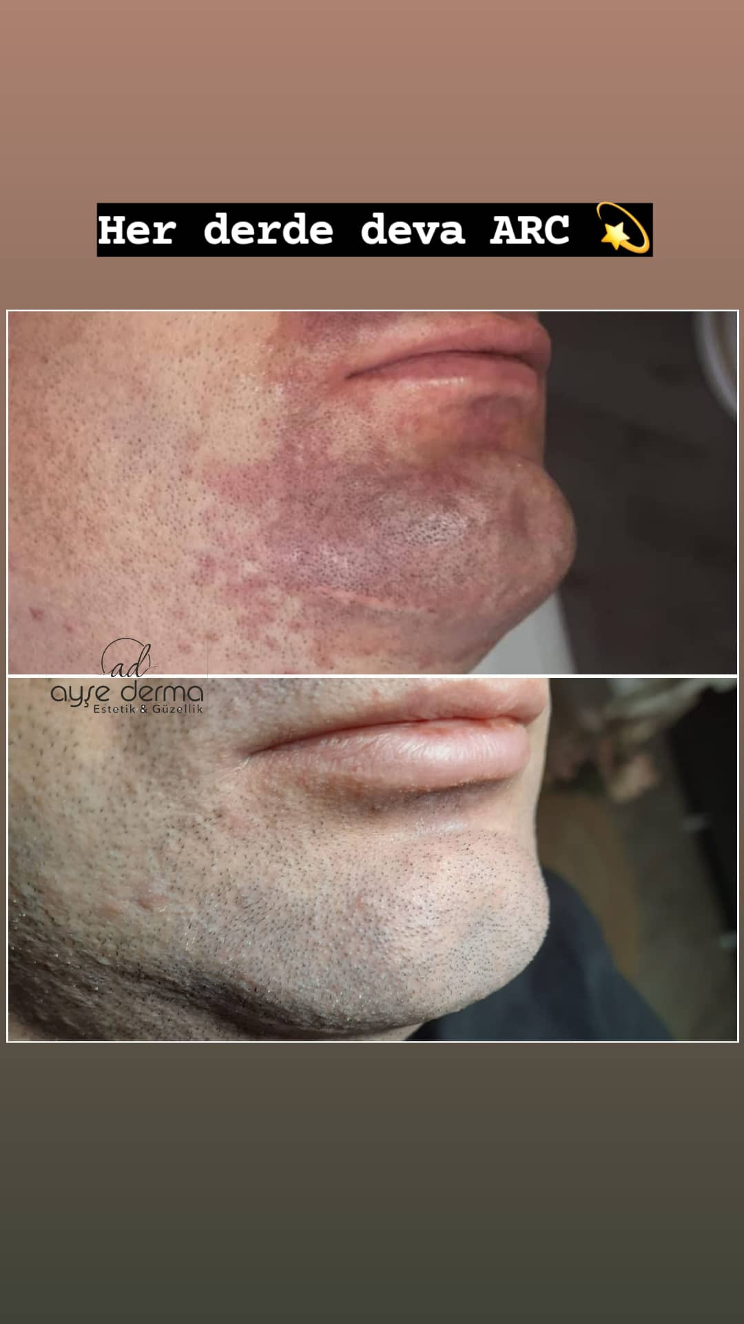 Ayşe Derma – Fotoğraf 8