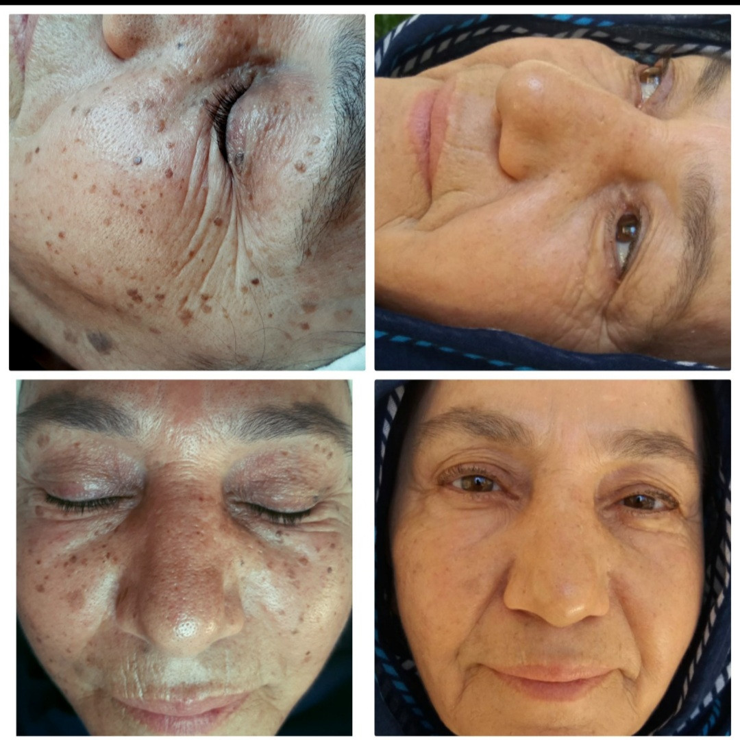 Ayşe Derma – Fotoğraf 10