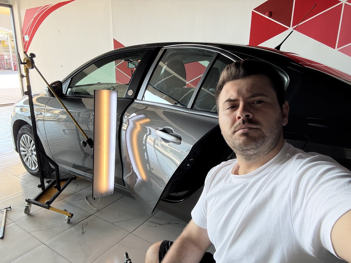 Body Line Boyasız Göçük Düzeltme Merkezi – Fotoğraf 9