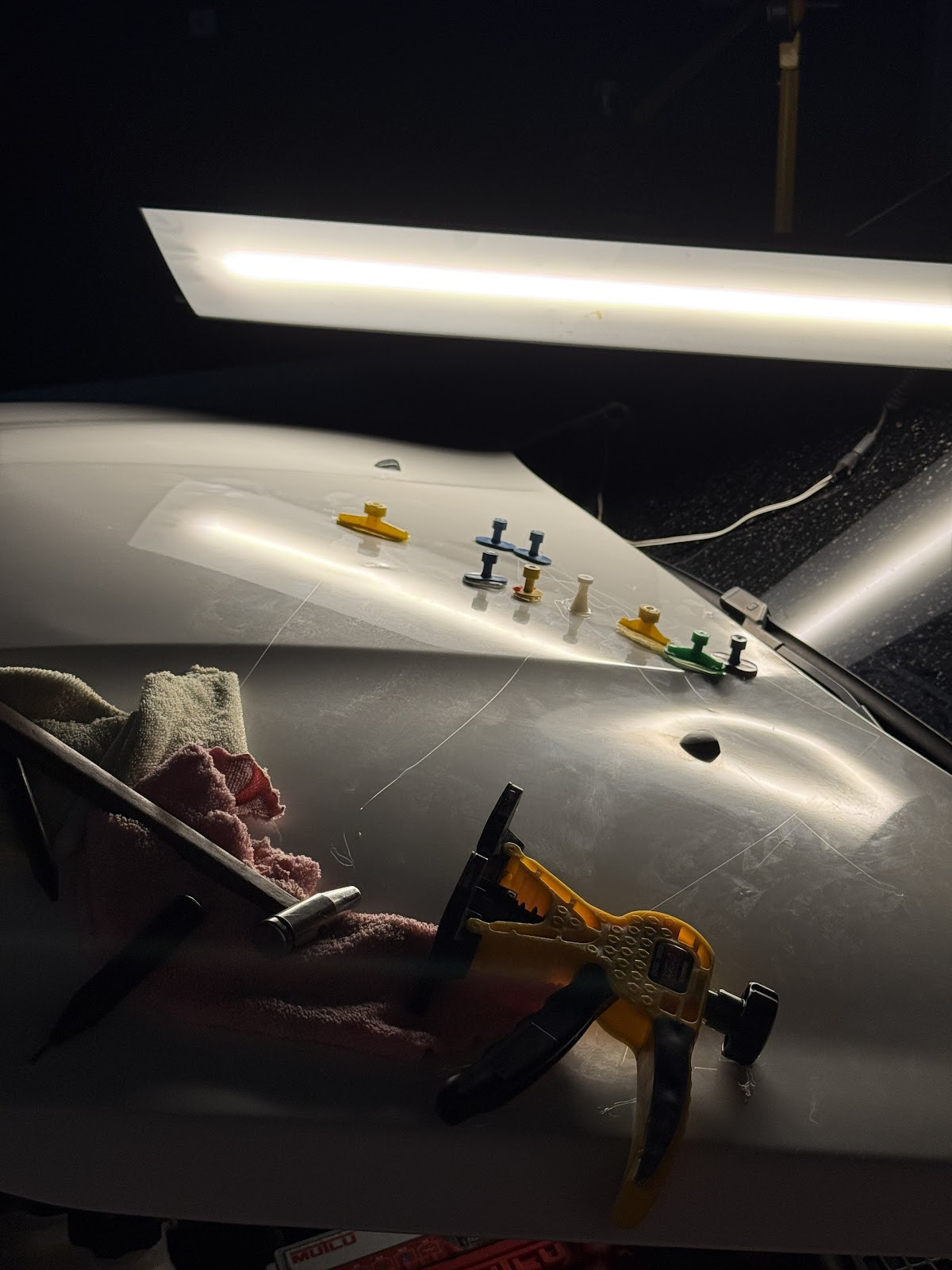 Body Line Boyasız Göçük Düzeltme Merkezi – Fotoğraf 6