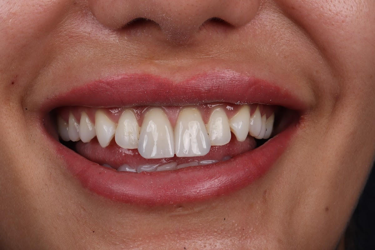 ÇENE CERRAHİSİ UZMANI DR RECEP SERDAR KIRICI – Fotoğraf 5