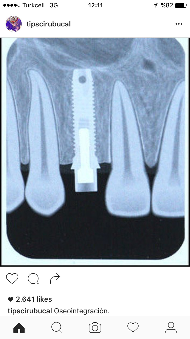 ÇENE CERRAHİSİ UZMANI DR RECEP SERDAR KIRICI – Fotoğraf 4