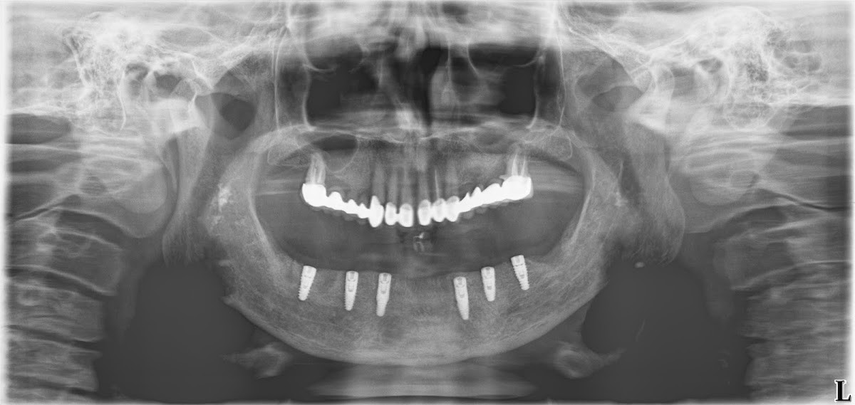 ÇENE CERRAHİSİ UZMANI DR RECEP SERDAR KIRICI – Fotoğraf 3