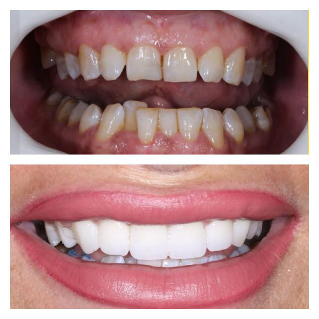 Denart Dental Clinic – Fotoğraf 6