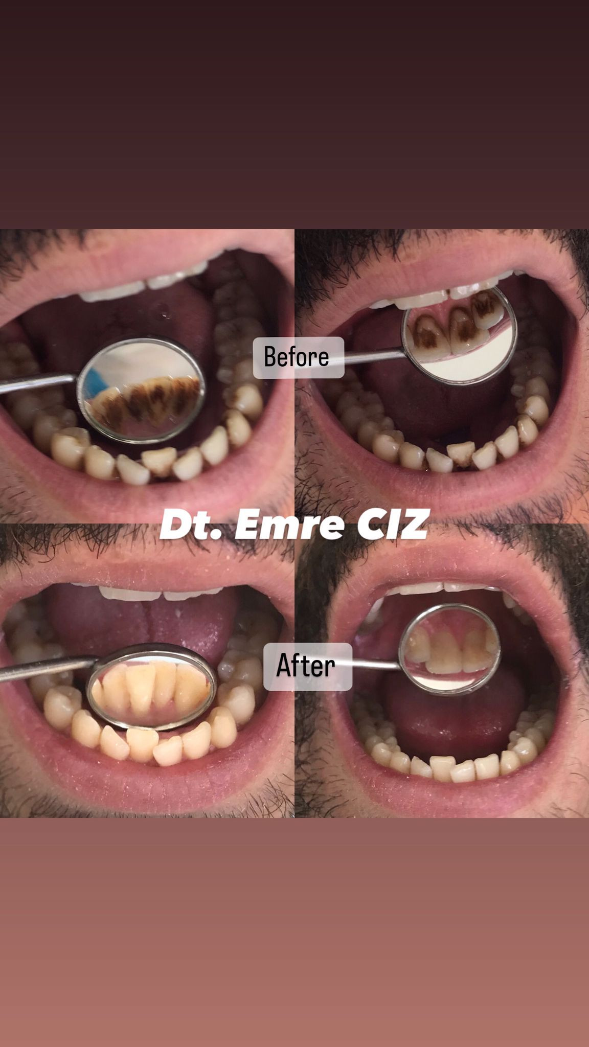 Diş Hekimi Emre Cız – Fotoğraf 2