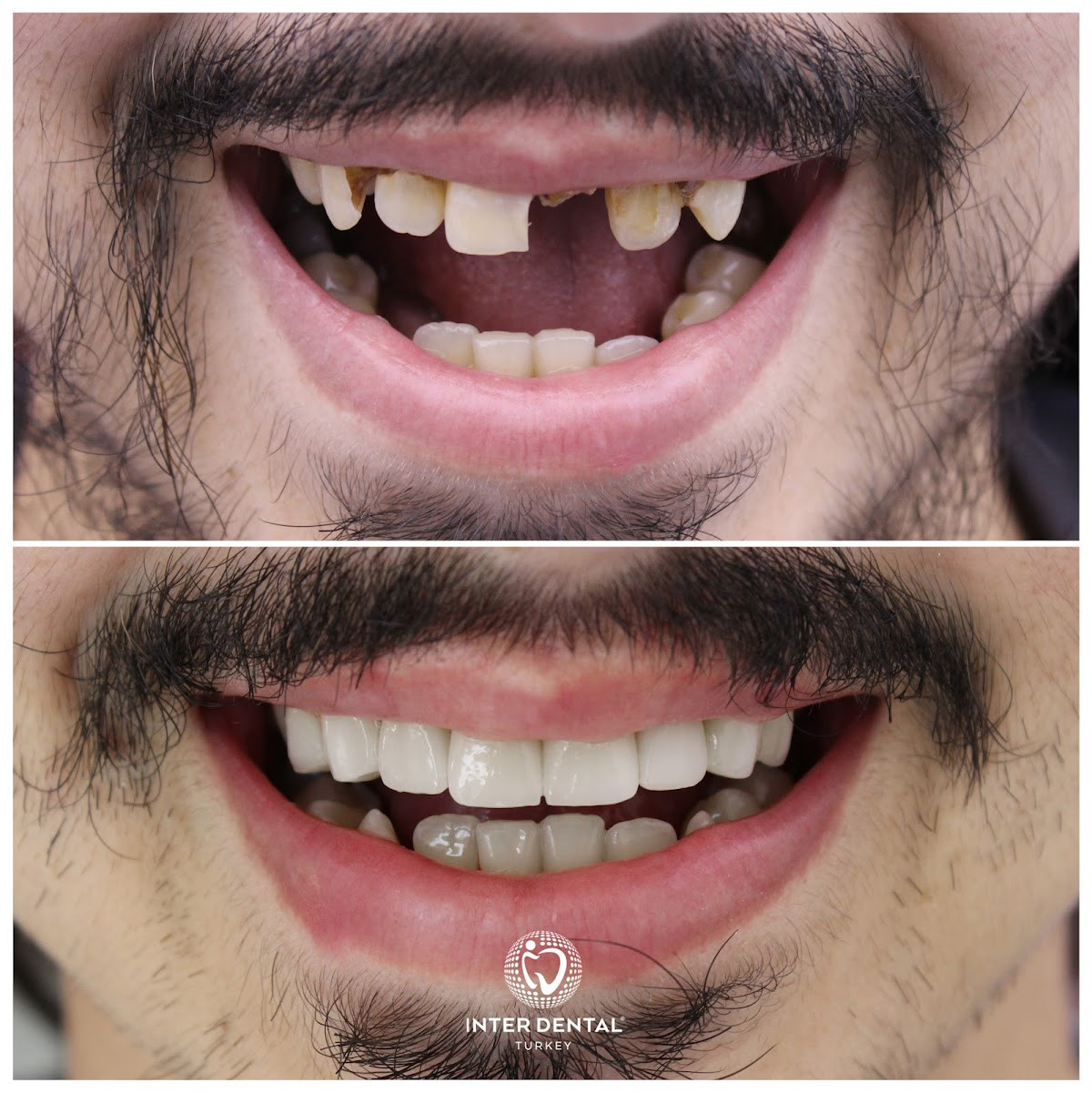 Inter Dental Turkey – Fotoğraf 7