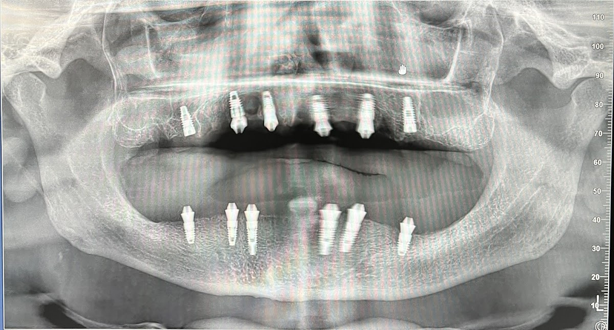 Kestel Diş Hekimi Nur Alisultangil – Fotoğraf 6