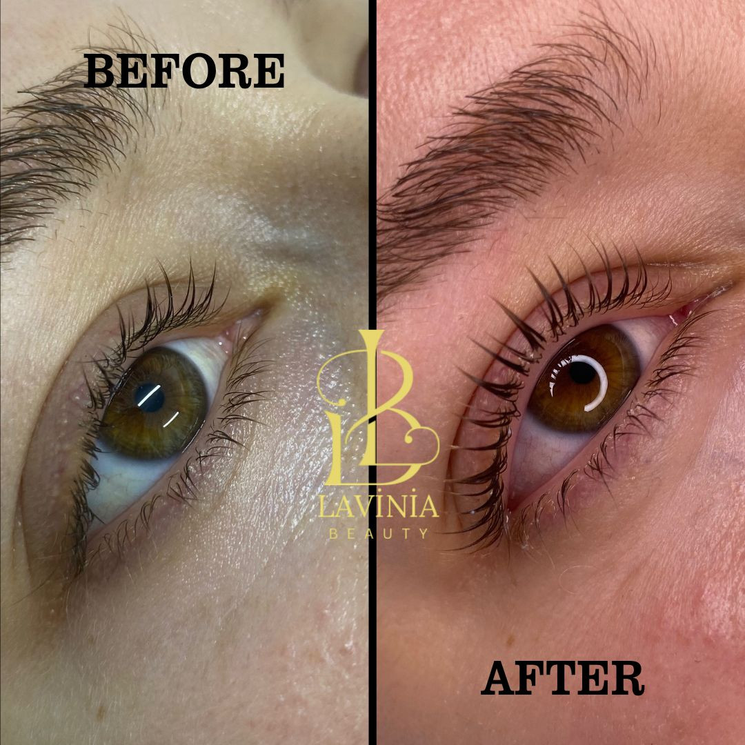 LAVİNİA GÜZELLİK MERKEZİ (Bayanlara özel) – Fotoğraf 6