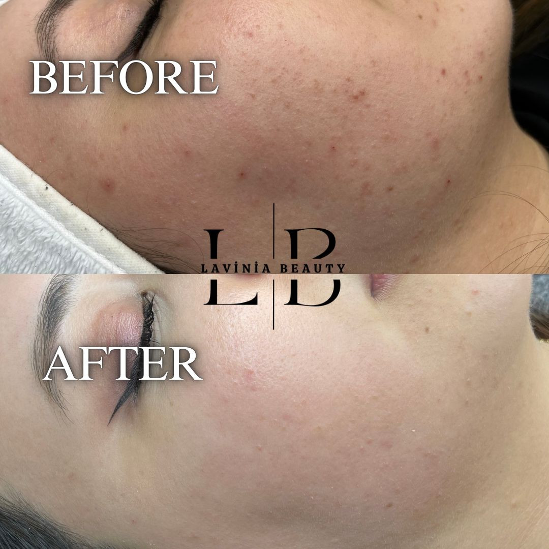 LAVİNİA GÜZELLİK MERKEZİ (Bayanlara özel) – Fotoğraf 9