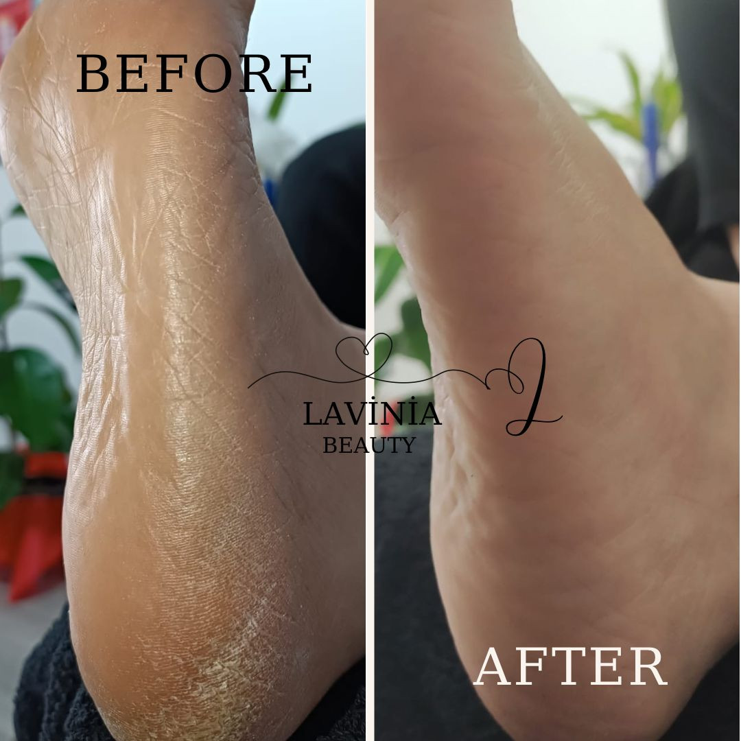 LAVİNİA GÜZELLİK MERKEZİ (Bayanlara özel) – Fotoğraf 8