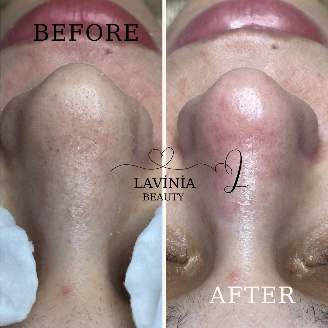 LAVİNİA GÜZELLİK MERKEZİ (Bayanlara özel) – Fotoğraf 10