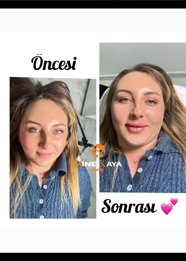 Loca Beauty Mine Kaya – Fotoğraf 4