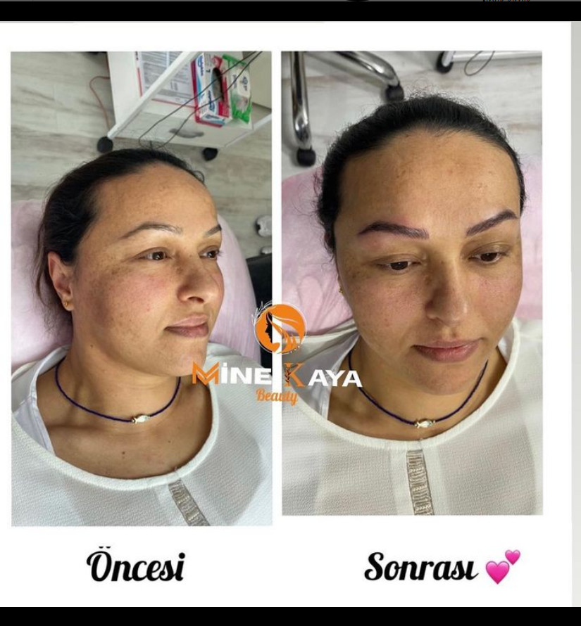 Loca Beauty Mine Kaya – Fotoğraf 6