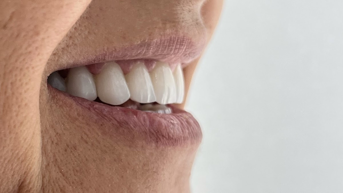 Magical Dental Center | Implant & Smile Studio – Fotoğraf 8