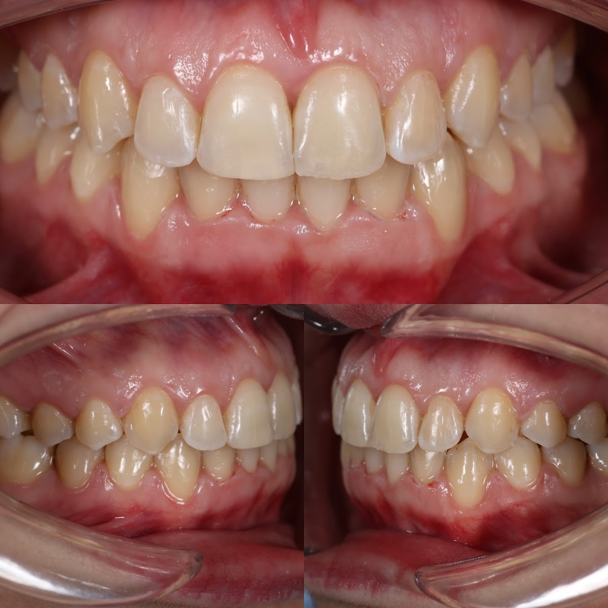 Manavgat Ortodonti- Uzm. Dt. Arif Okutan – Fotoğraf 10