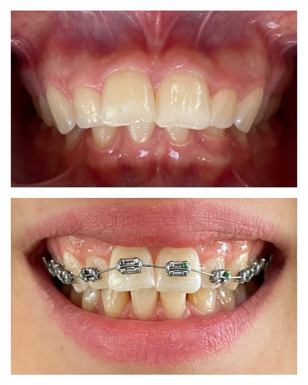 Manavgat Ortodonti- Uzm. Dt. Arif Okutan – Fotoğraf 9