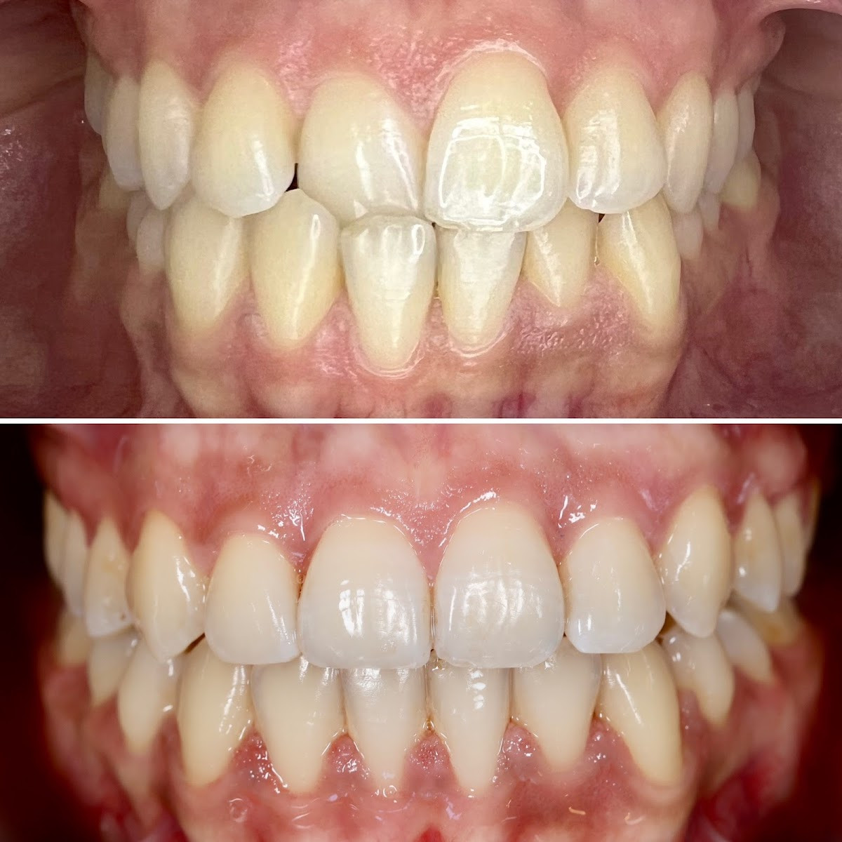 Manavgat Ortodonti- Uzm. Dt. Arif Okutan – Fotoğraf 8