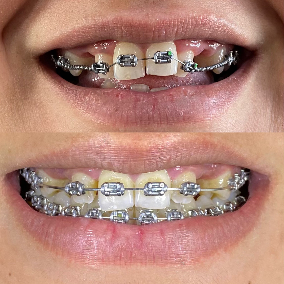 Manavgat Ortodonti- Uzm. Dt. Arif Okutan – Fotoğraf 6