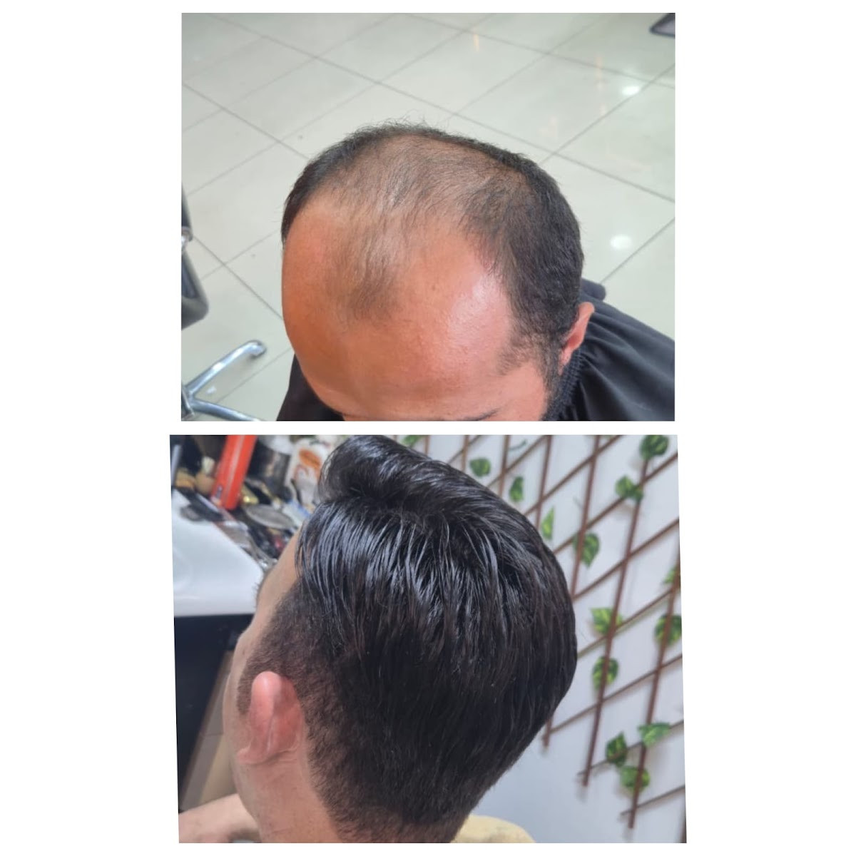 Manavgat Protez Saç – Fotoğraf 4