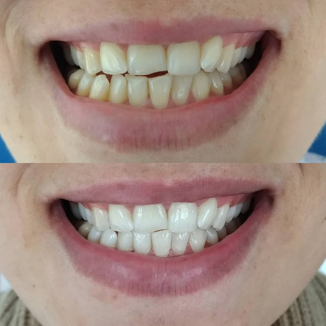 MODERN AĞIZ VE DİŞ SAĞLIĞI POLİKLİNİĞİ – Fotoğraf 7