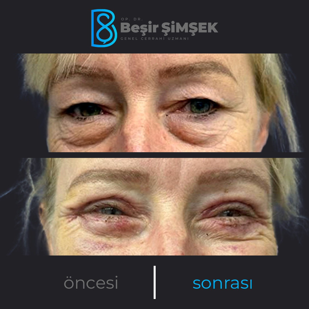 Op. Dr. Beşir Şimşek – Fotoğraf 9