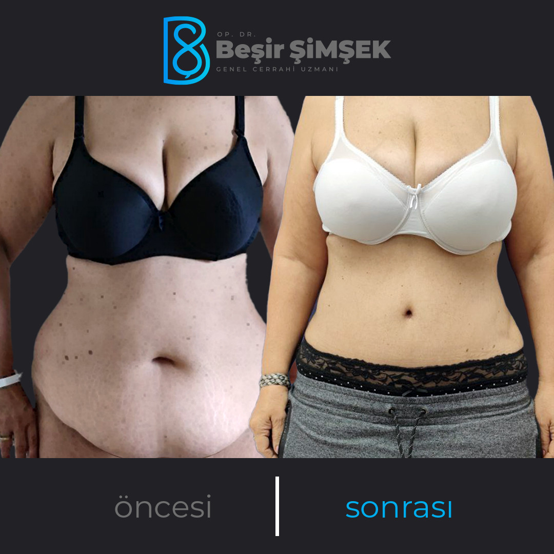 Op. Dr. Beşir Şimşek – Fotoğraf 10