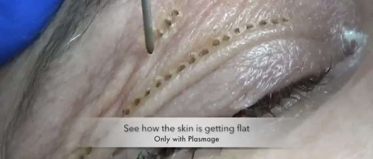 Op. Dr. Serhat E. Yılmaz /Göz Doktoru -Augenarzt -Ophthalmologist – Fotoğraf 6