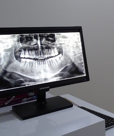 Özel Şelale Ağız ve Diş Sağlığı Polikliniği - Manavgat Diş – Fotoğraf 8