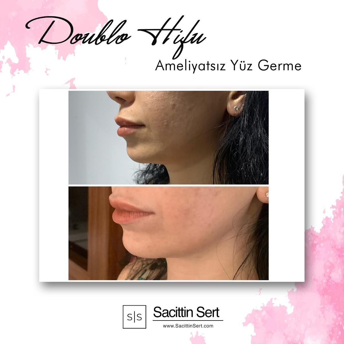 Sacittin Sert – Fotoğraf 7