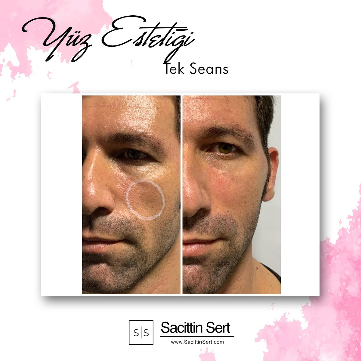 Sacittin Sert – Fotoğraf 10