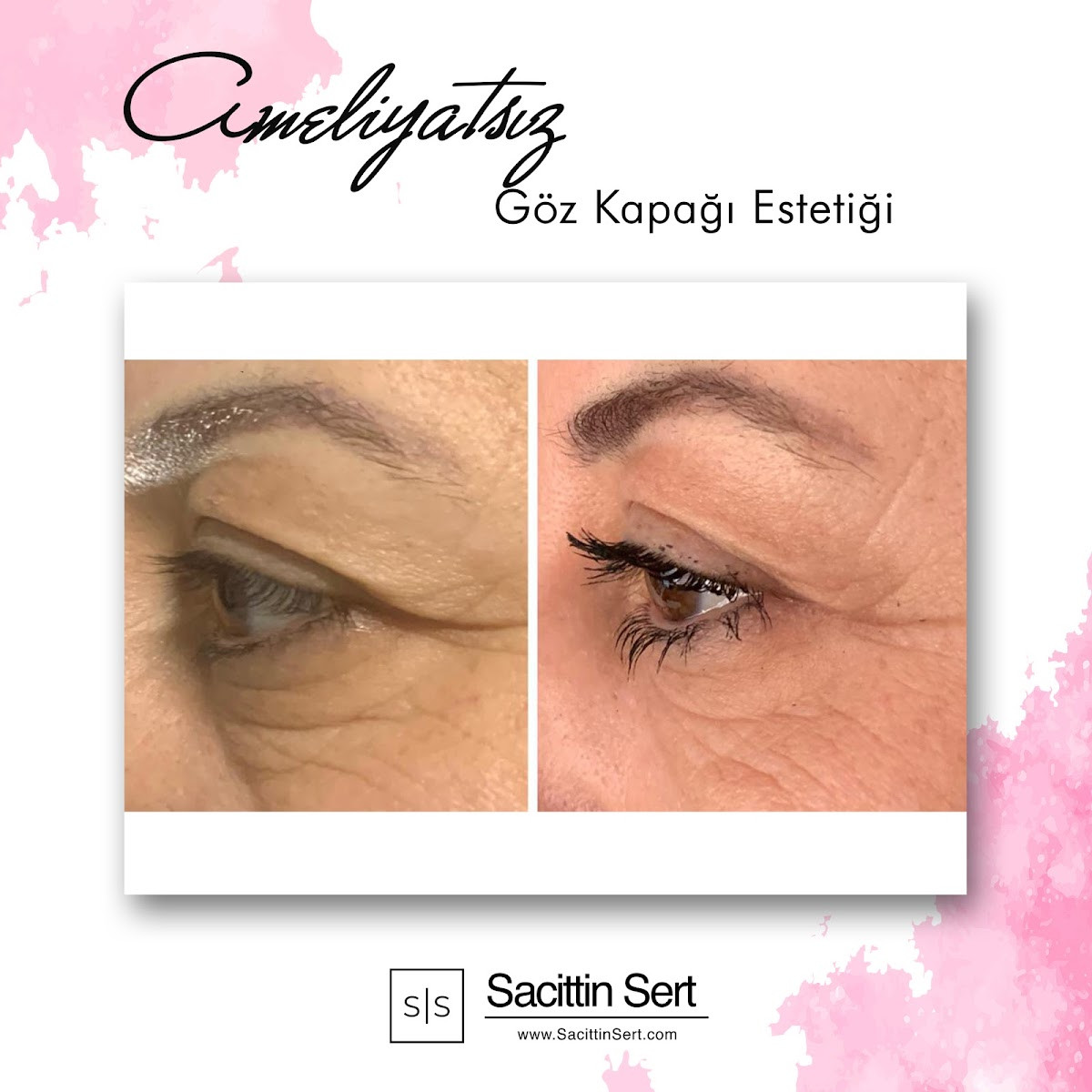 Sacittin Sert – Fotoğraf 9