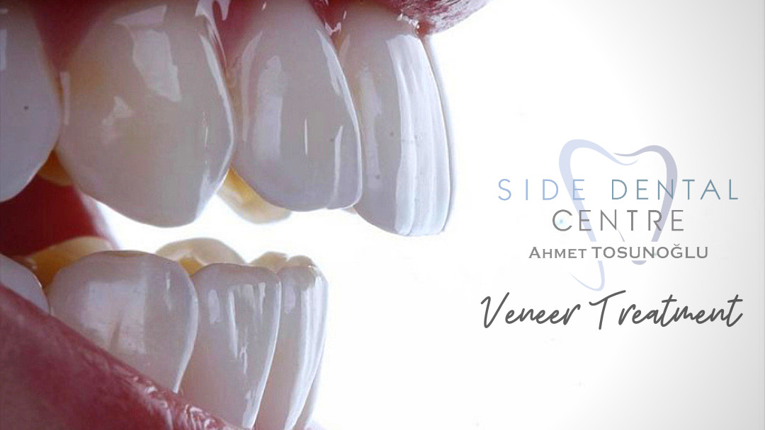 Side Dental Centre – Fotoğraf 3