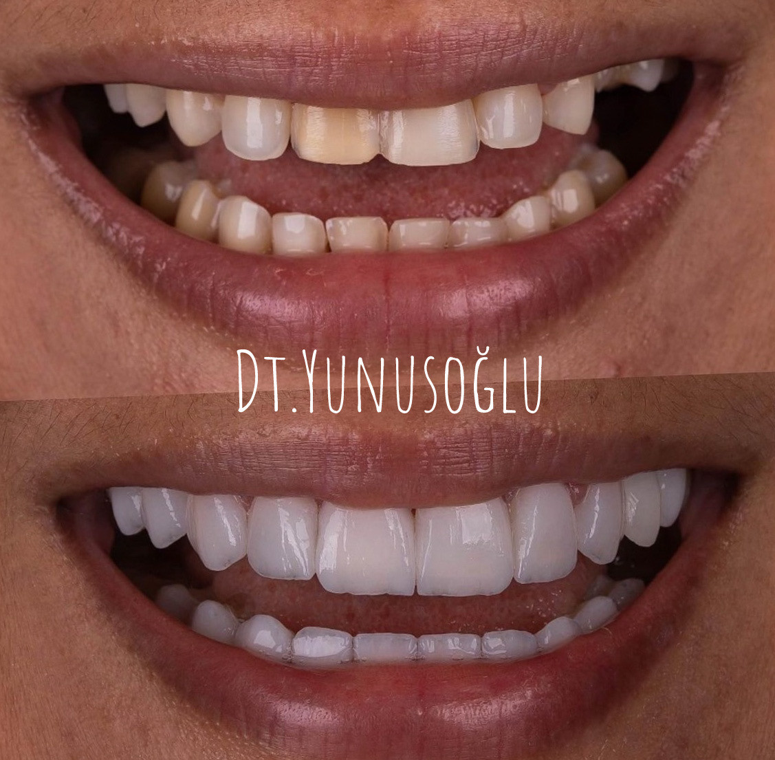 Side Smile Center (Dt.Mustafa Yunusoğlu) Side Dental Clinic Side zahnklinik – Fotoğraf 2