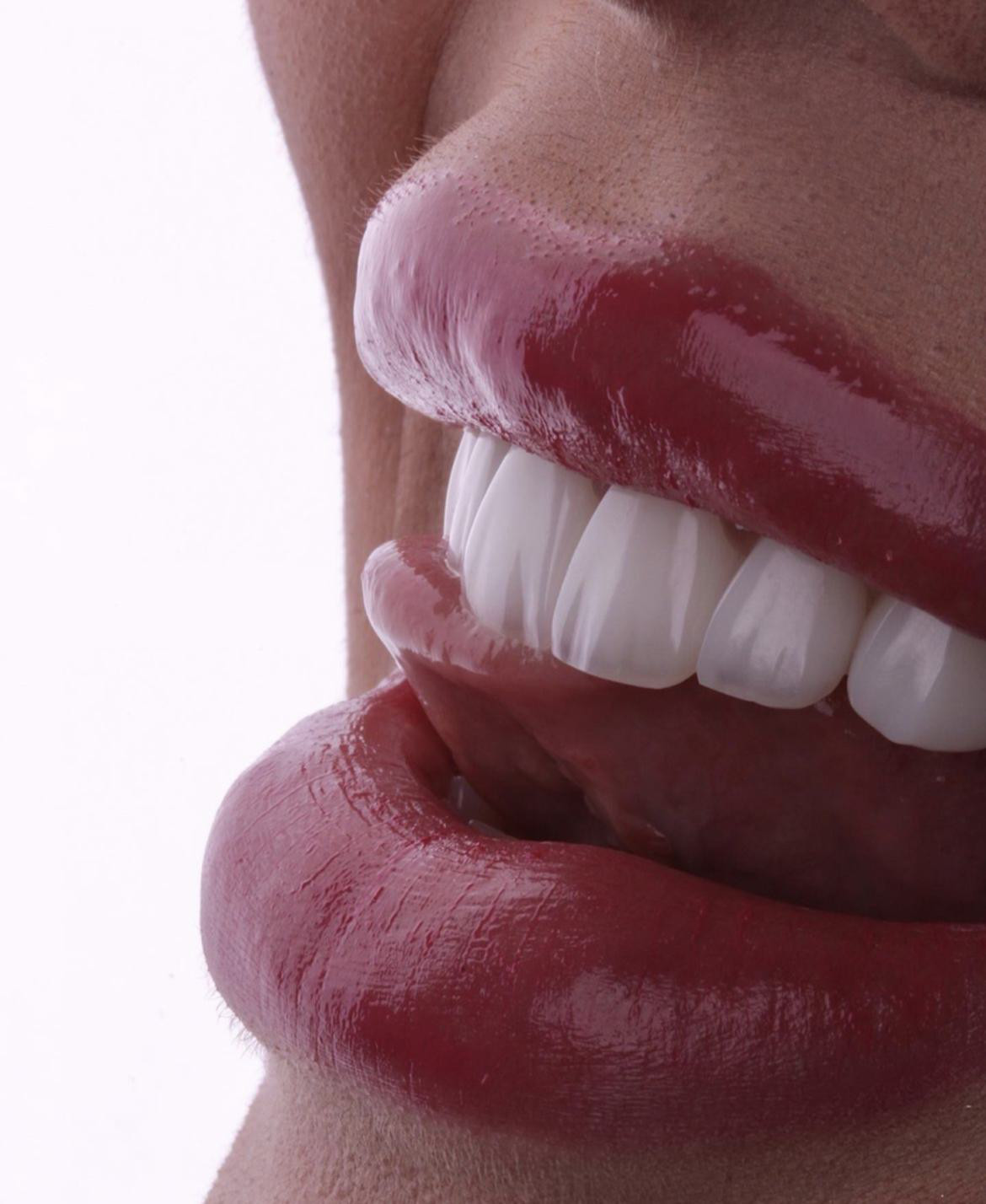 Side Smile Center (Dt.Mustafa Yunusoğlu) Side Dental Clinic Side zahnklinik – Fotoğraf 9