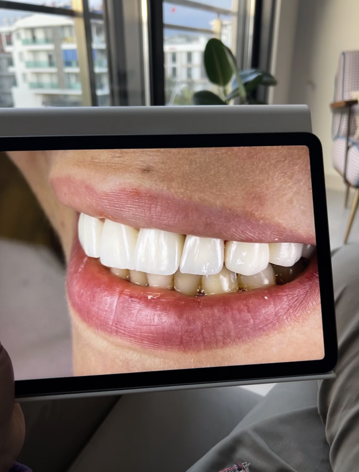 Side Smile Center (Dt.Mustafa Yunusoğlu) Side Dental Clinic Side zahnklinik – Fotoğraf 6