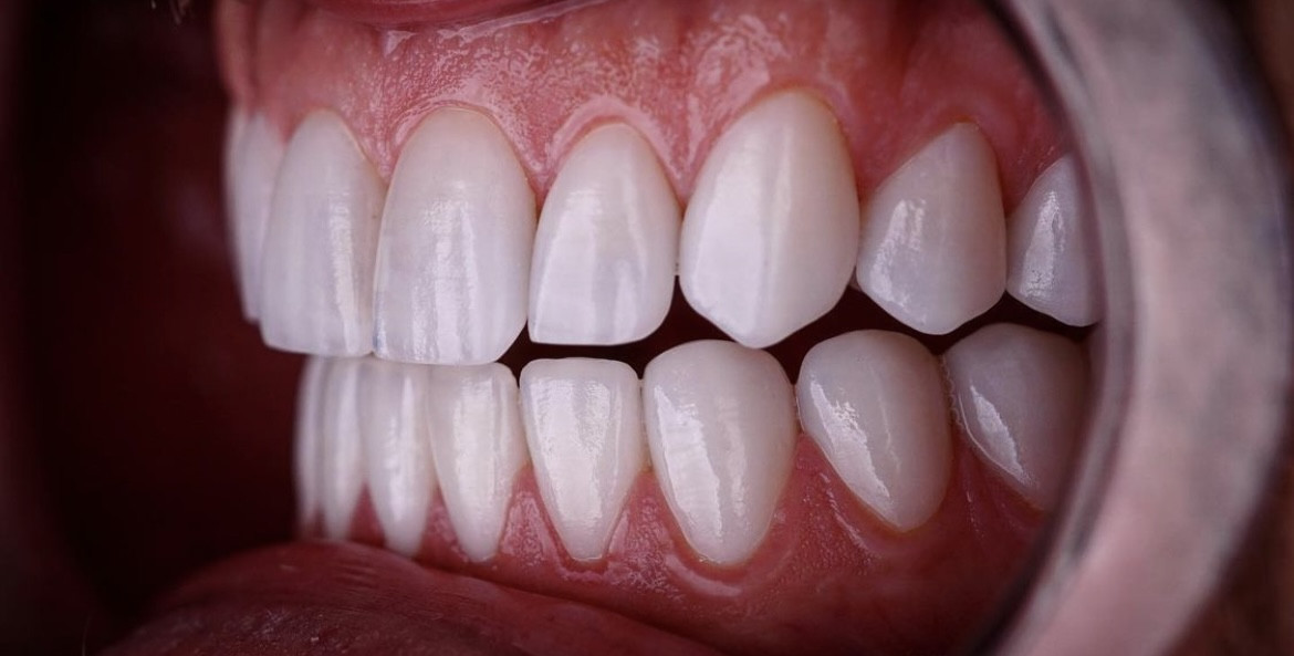 Side Smile Center (Dt.Mustafa Yunusoğlu) Side Dental Clinic Side zahnklinik