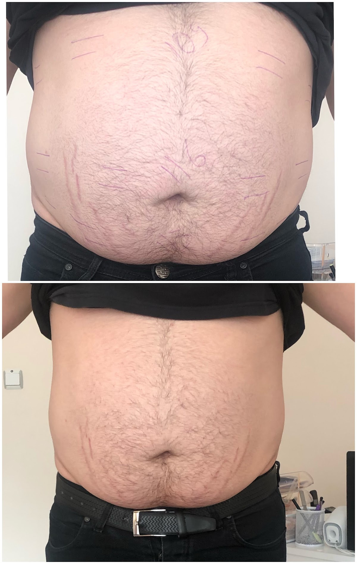 Sorgun Lazer Epilasyon Ve Güzellik Merkezi – Fotoğraf 5