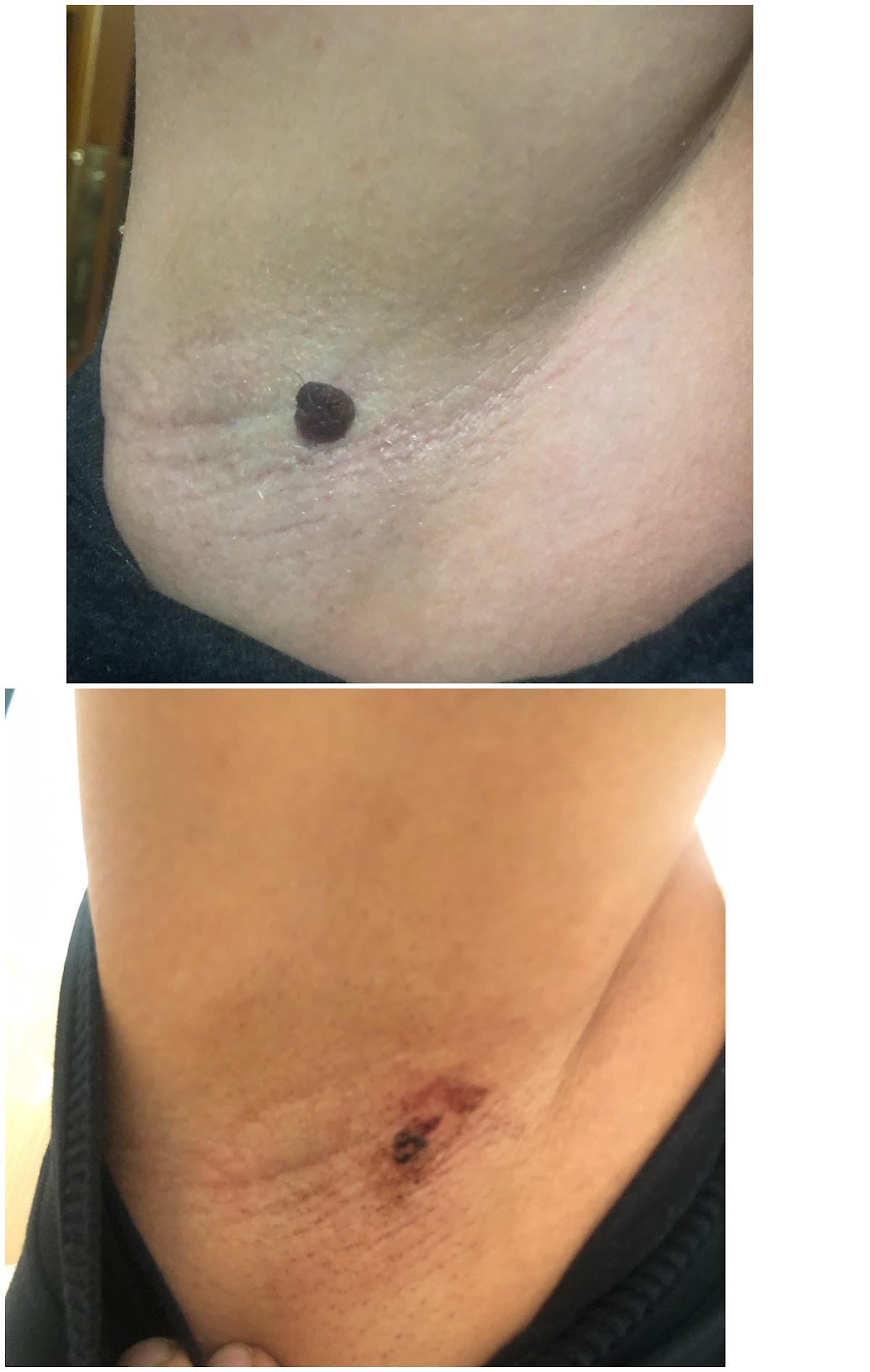 Sorgun Lazer Epilasyon Ve Güzellik Merkezi – Fotoğraf 9