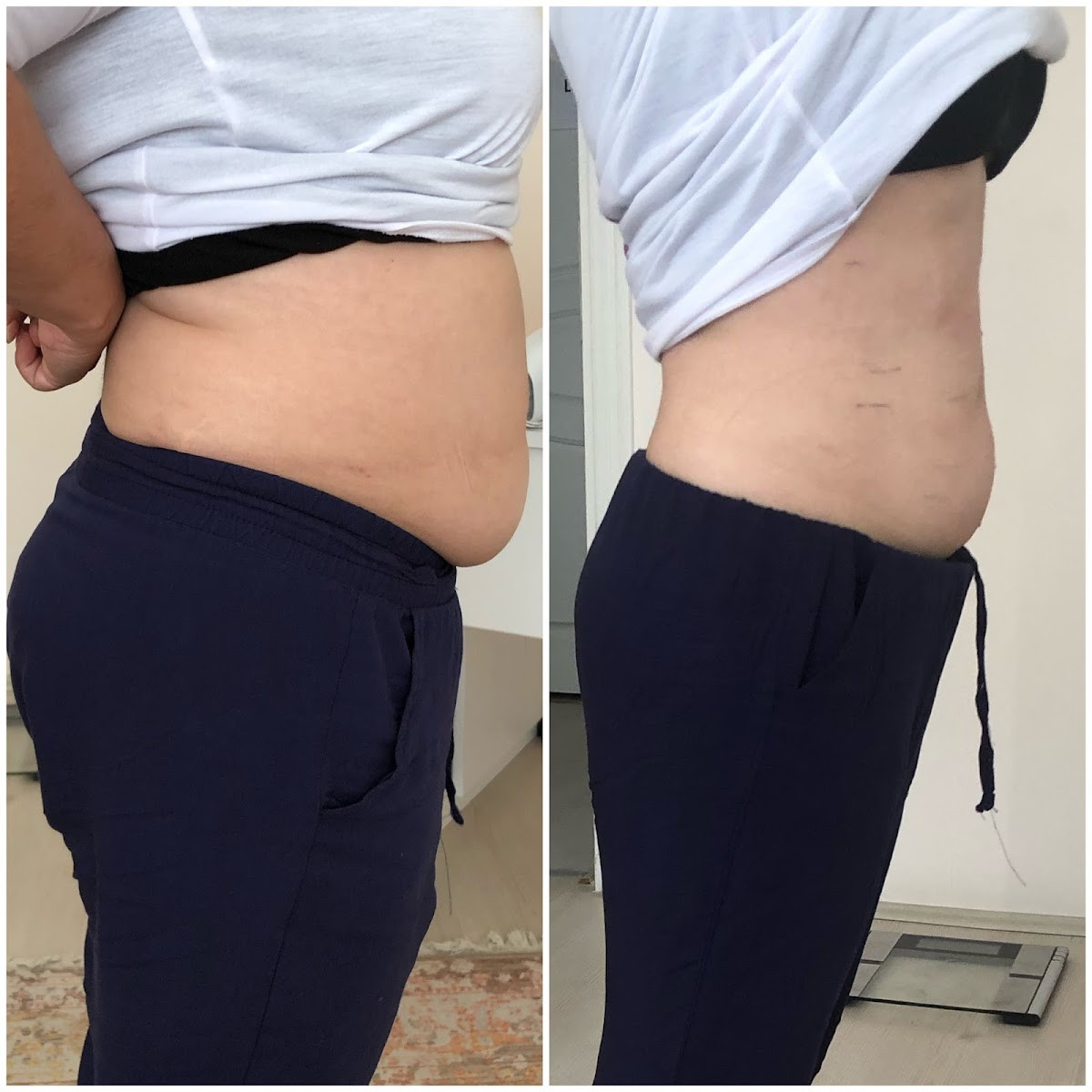 Sorgun Lazer Epilasyon Ve Güzellik Merkezi – Fotoğraf 4