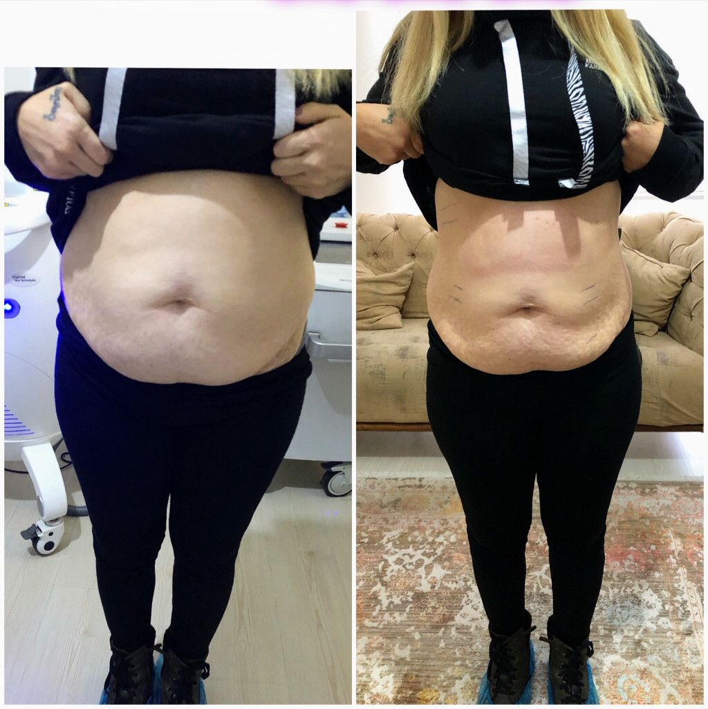 Sorgun Lazer Epilasyon Ve Güzellik Merkezi – Fotoğraf 3