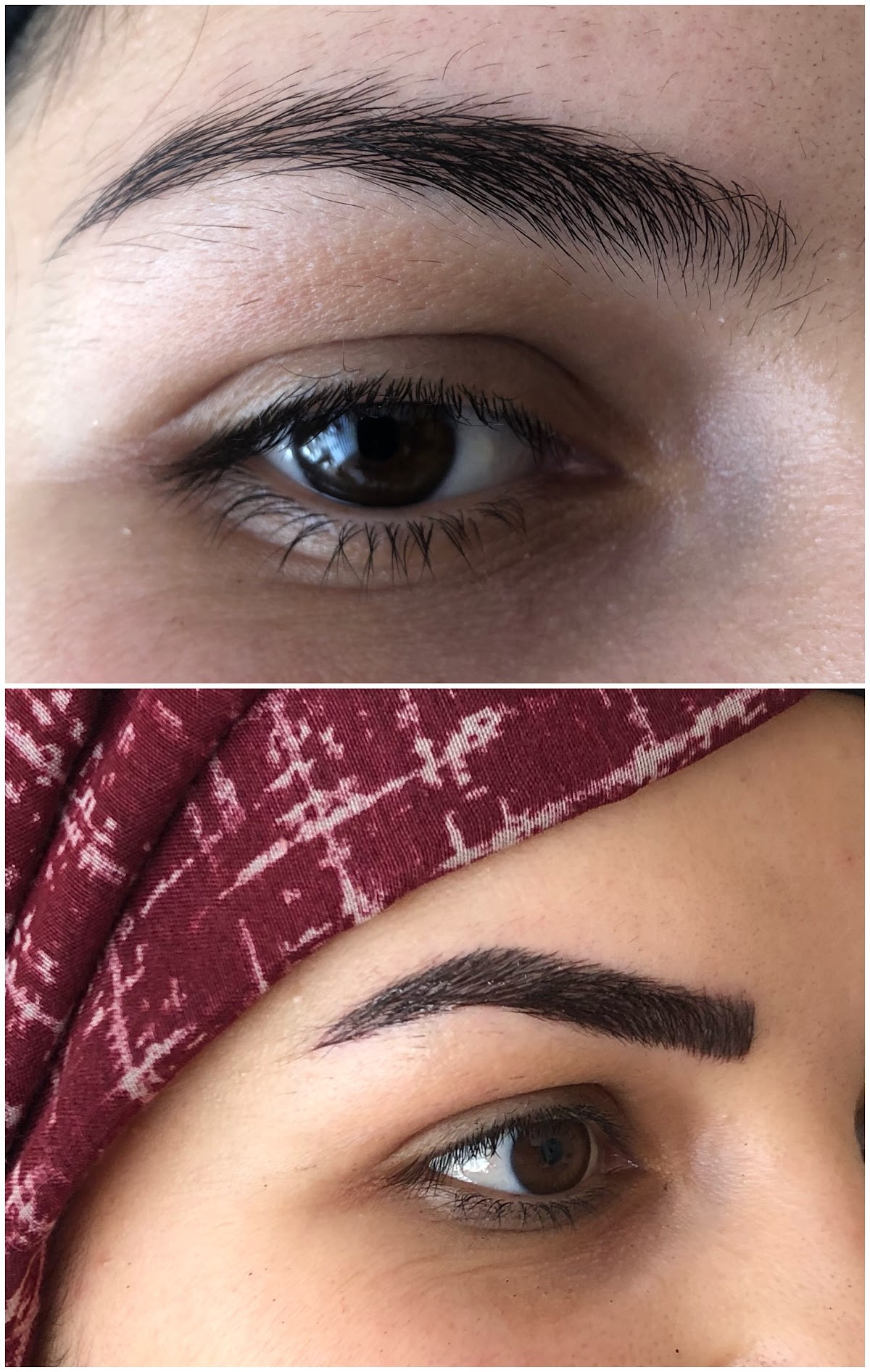 Sorgun Lazer Epilasyon Ve Güzellik Merkezi – Fotoğraf 8