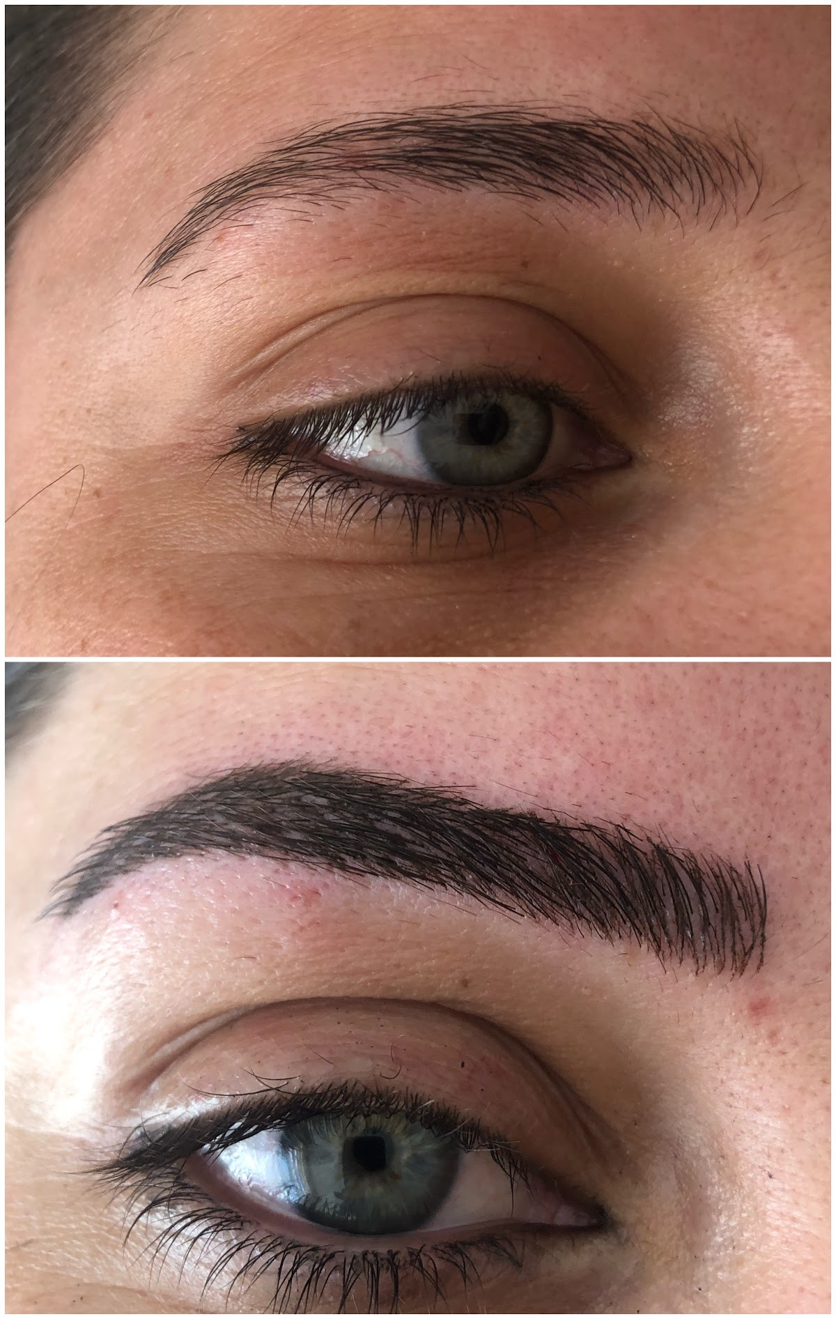 Sorgun Lazer Epilasyon Ve Güzellik Merkezi – Fotoğraf 10