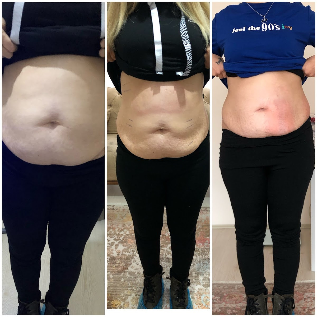 Sorgun Lazer Epilasyon Ve Güzellik Merkezi – Fotoğraf 2