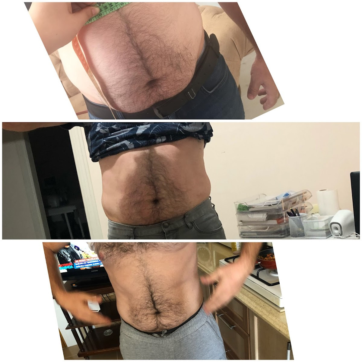 Sorgun Lazer Epilasyon Ve Güzellik Merkezi – Fotoğraf 7