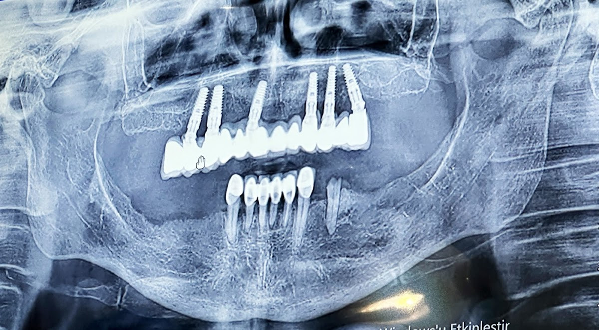 Teethouse Diş kliniği | Diş Hekimi | Dentist | Zahnarzt – Fotoğraf 8
